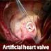 Artificial heart valve 